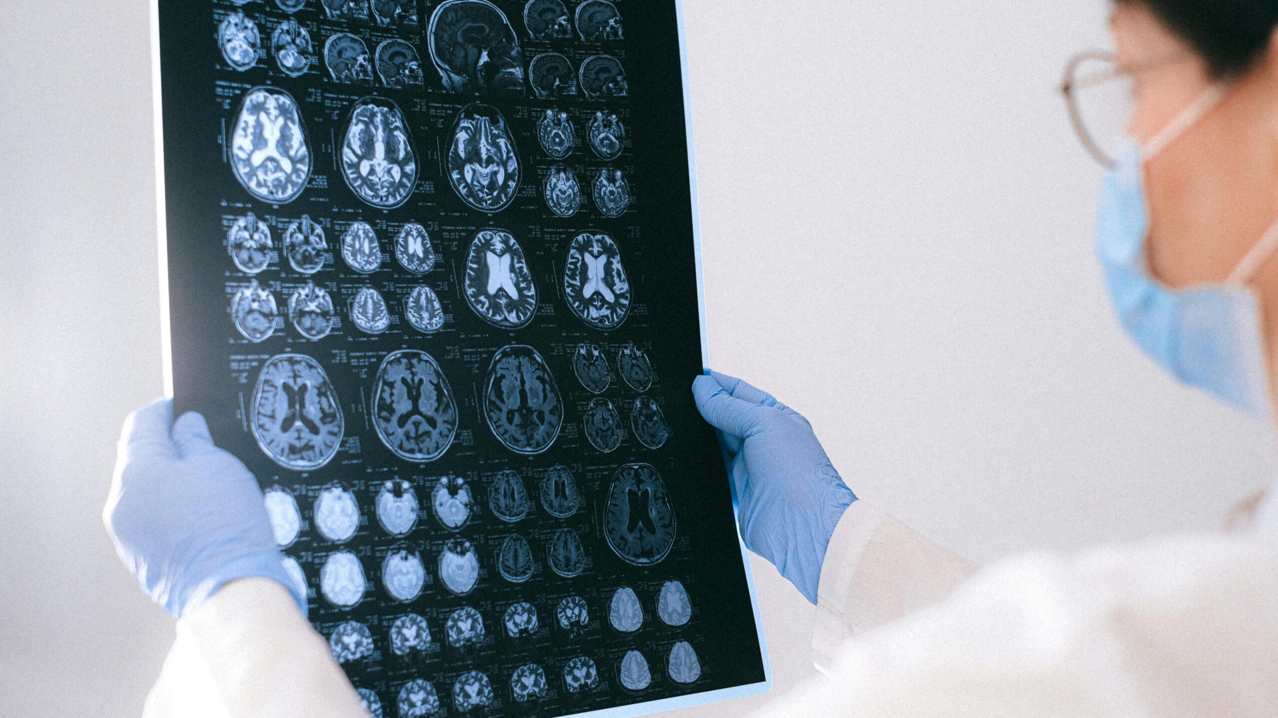 A medical professional reviewing MRI brain scans in a clinical setting, highlighting healthcare technology.